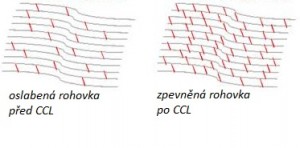 Oční klinika NeoVize, léčba keratokonu, metoda CCL